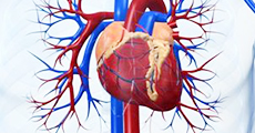 Cardiovascular disease